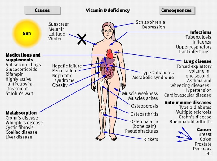 Vitamin deficiency risks infographic body health low risk vitamins level helps signs good deficient cancer pain remedies cure easyhealthoptions fact