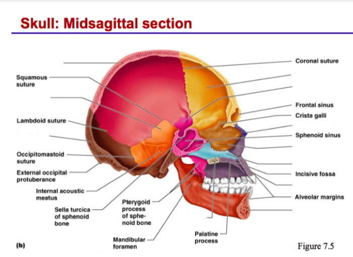 Midsagittal view of the skull