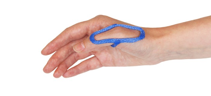 Splint wrist mcp support ring rolyan hand supports splints cock healthandcare splinting also positioning