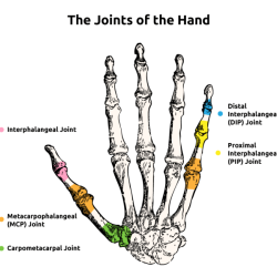 Metacarpophalangeal mcp joint blocking splint