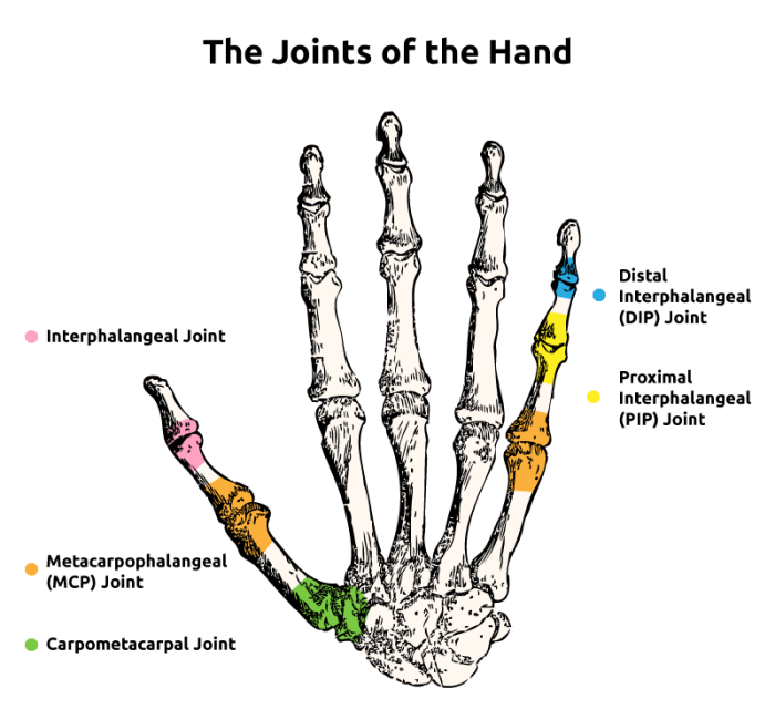 Metacarpophalangeal mcp joint blocking splint